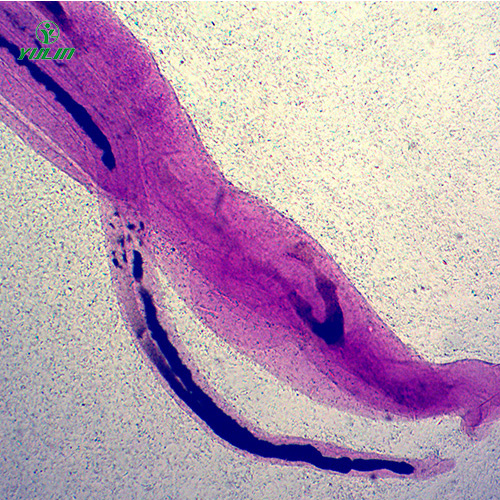 日本血吸虫雌雄合抱装片