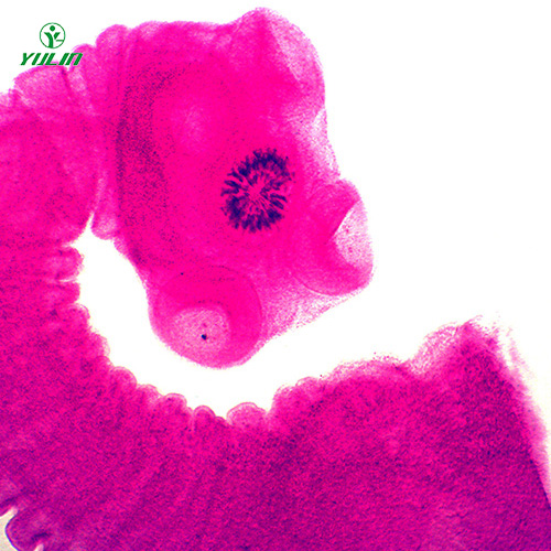 医学蠕虫绦虫装片