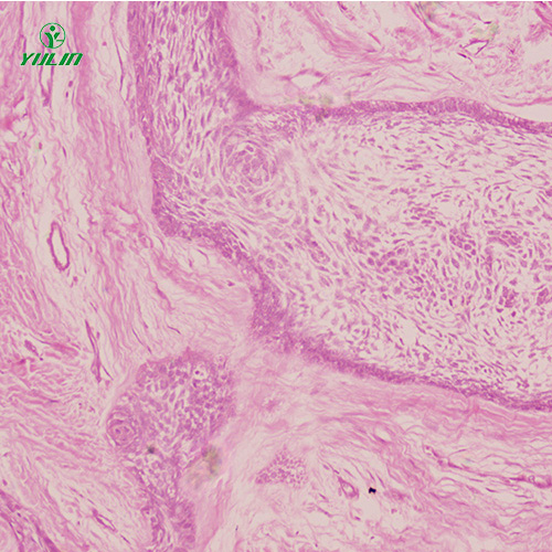 人口腔病理标本片