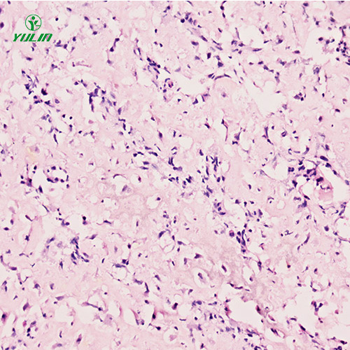 人肌肉骨骼系统疾病标本片