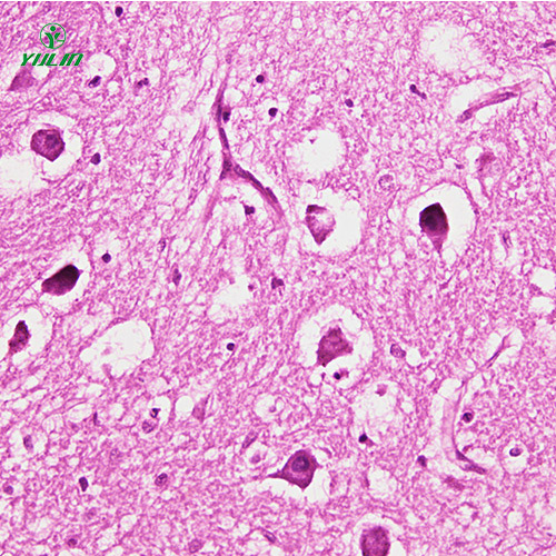 人神经系统疾病标本片