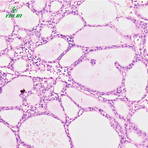 人内分泌系统疾病标本片