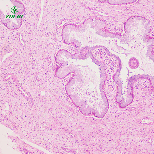人泌尿生殖系统疾病标本片