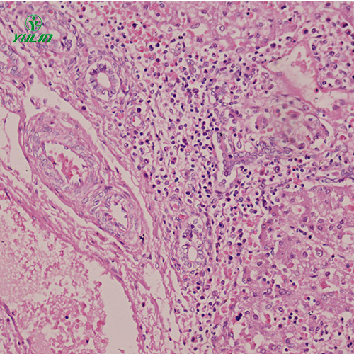 人消化系统疾病标本片
