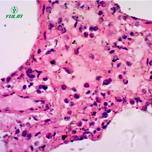 人呼吸系统疾病标本片