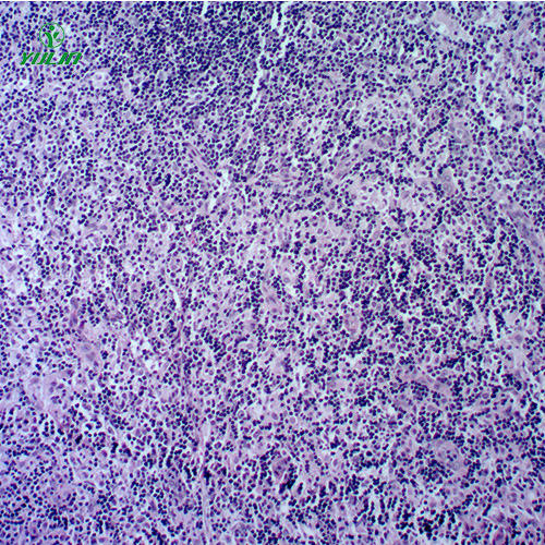 人体免疫性疾病切片