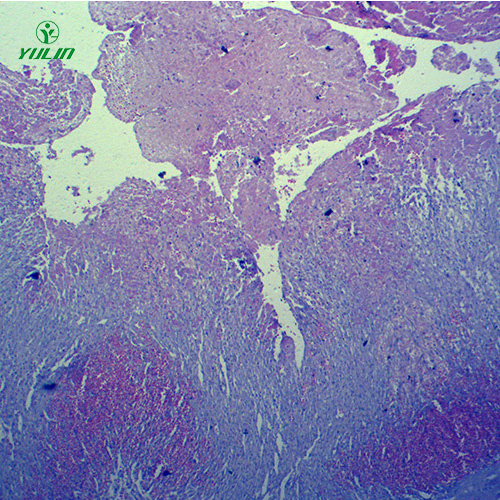人体局部血液循环障碍病理玻片