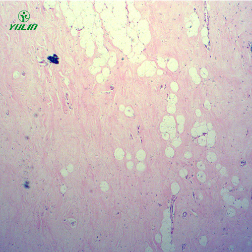 人体细胞组织损伤病理切片