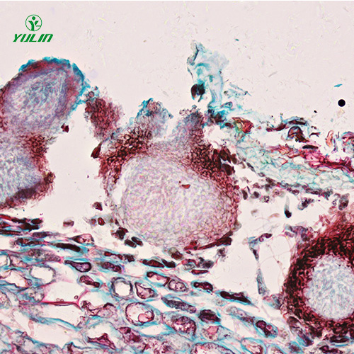 水果病害标本片