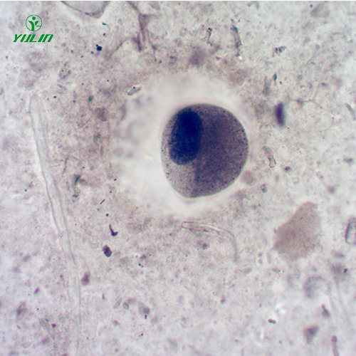 医学寄生虫纤毛虫玻片